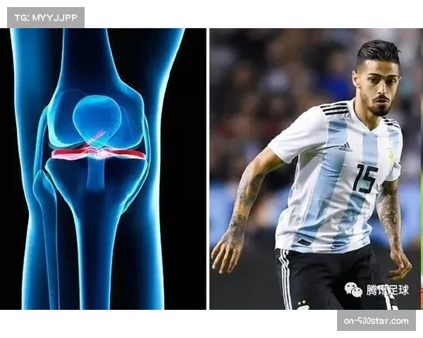 足球医学突破性进展 膝关节重伤恢复时间缩短三成 足球医学突破性进展 膝关节重伤恢复时间缩短三成